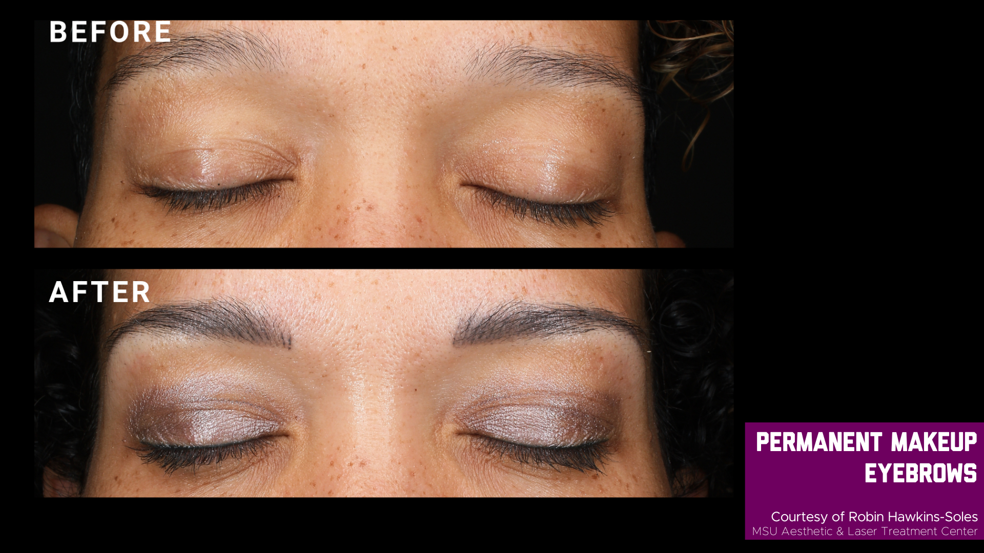 before and after treatment photos